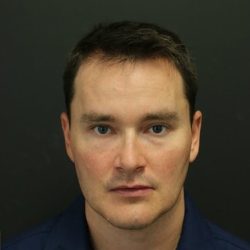 Fat Grafting Before & After Patient #1189
