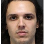 Rhinoplasty Before & After Patient #1213