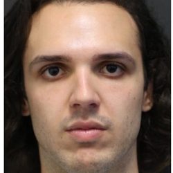 Rhinoplasty Before & After Patient #1213