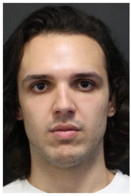 Rhinoplasty Before & After Patient #1213