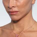 Facelift Before & After Patient #3047