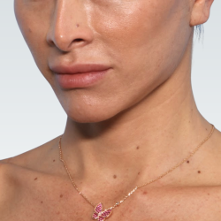 Facelift Before & After Patient #3047