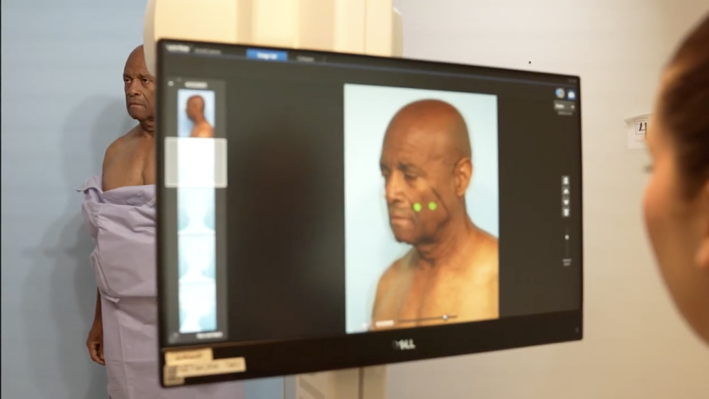 Male Brow Lift